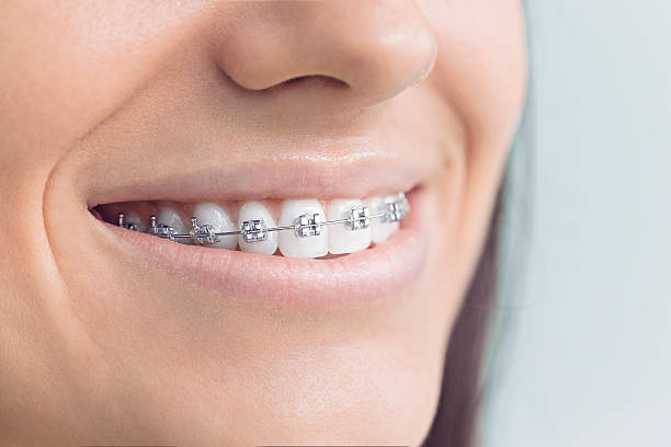 Best Root Canal Treatment  in Swartz, LA